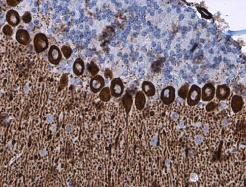IP3 Receptor 1 Antibody in Immunohistochemistry (Paraffin) (IHC (P))