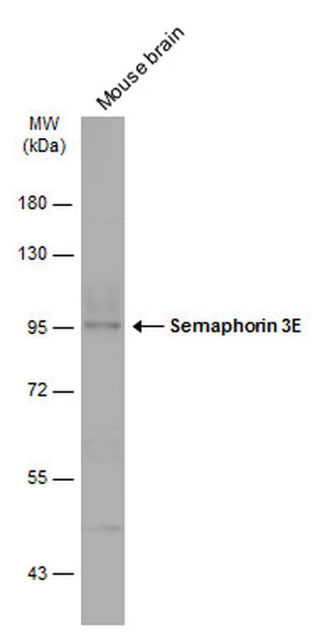 SEMA3E Antibody in Western Blot (WB)