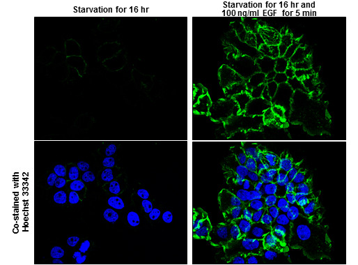 Phospho-EGFR (Tyr992) Antibody in Immunocytochemistry (ICC/IF)