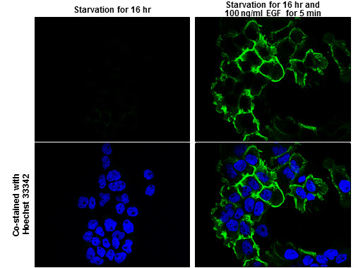 Phospho-EGFR (Tyr1173) Antibody in Immunocytochemistry (ICC/IF)