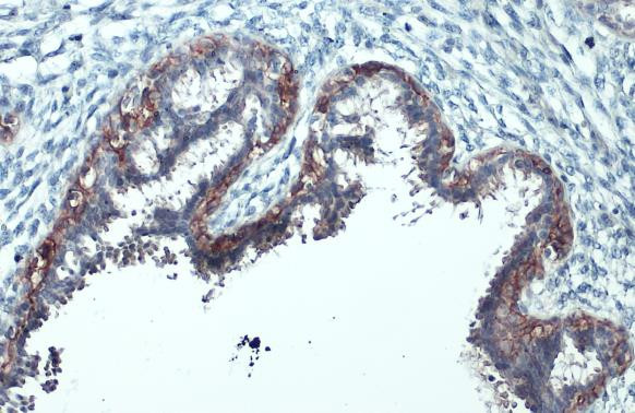Phospho-ErbB2 (HER-2) (Tyr1248) Antibody in Immunohistochemistry (Paraffin) (IHC (P))