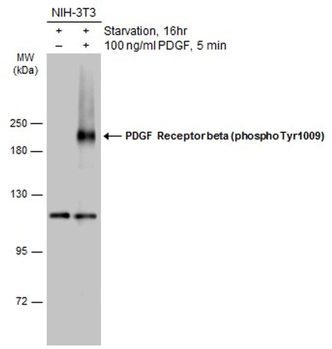Phospho-PDGFRB (Tyr1009) Antibody in Western Blot (WB)