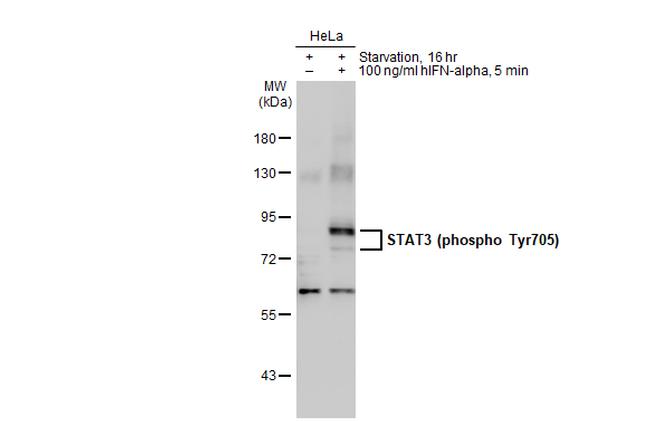 Phospho-STAT3 (Tyr705) Antibody in Western Blot (WB)