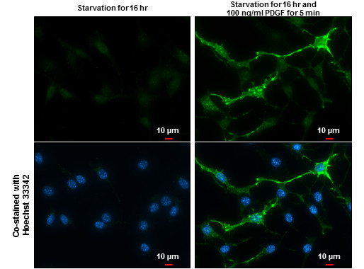 Phospho-PDGFRB (Tyr751) Antibody in Immunocytochemistry (ICC/IF)