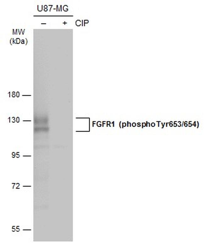 Phospho-FGFR1 (Tyr653, Tyr654) Antibody in Western Blot (WB)