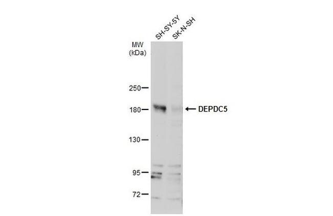 DEPDC5 Antibody in Western Blot (WB)
