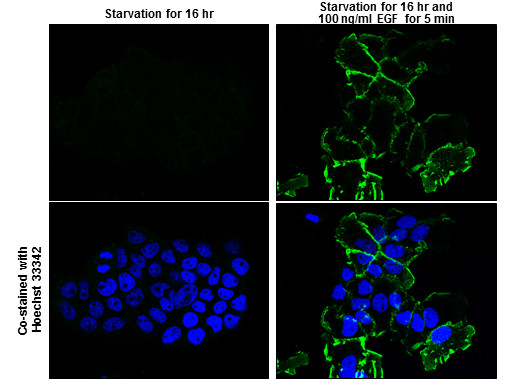 Phospho-EGFR (Tyr1148) Antibody in Immunocytochemistry (ICC/IF)