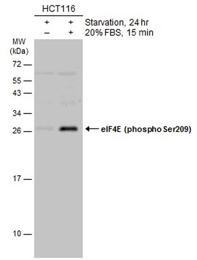 Phospho-eIF4E (Ser209) Antibody in Western Blot (WB)