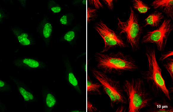 53BP1 Antibody in Immunocytochemistry (ICC/IF)