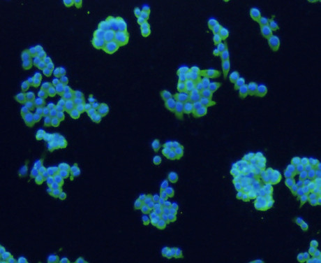 CD4 Antibody in Immunocytochemistry (ICC/IF)