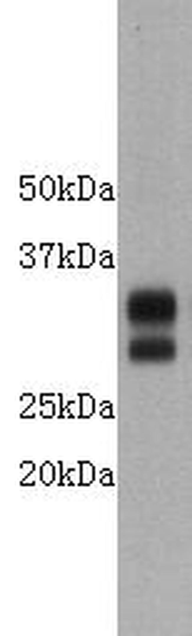 CD8 Antibody in Western Blot (WB)