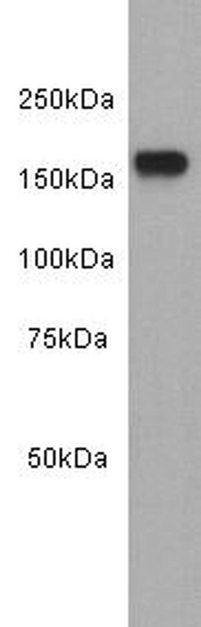 EGFR Antibody in Western Blot (WB)