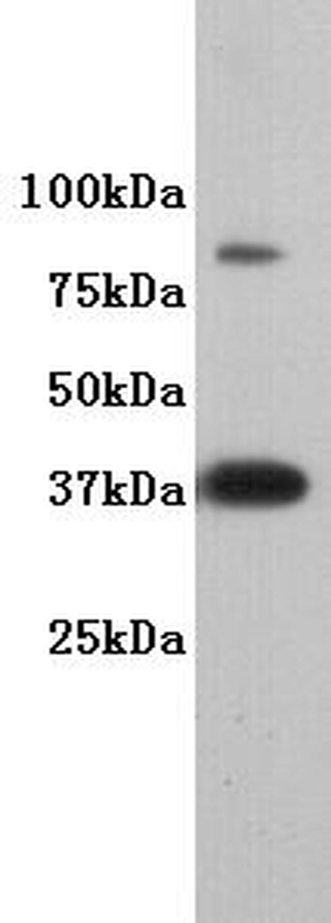 DPPA2 Antibody in Western Blot (WB)