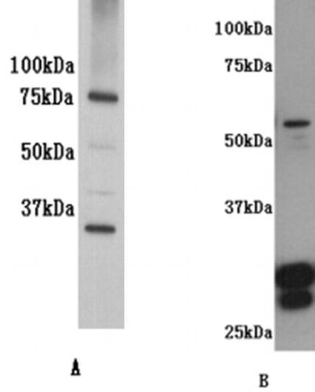 CD127 Antibody in Western Blot (WB)