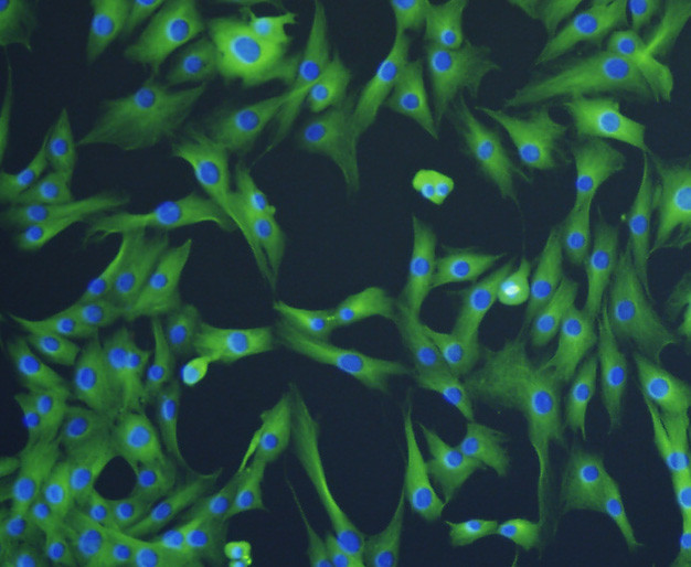 Beta III Tubulin Antibody in Immunocytochemistry (ICC/IF)