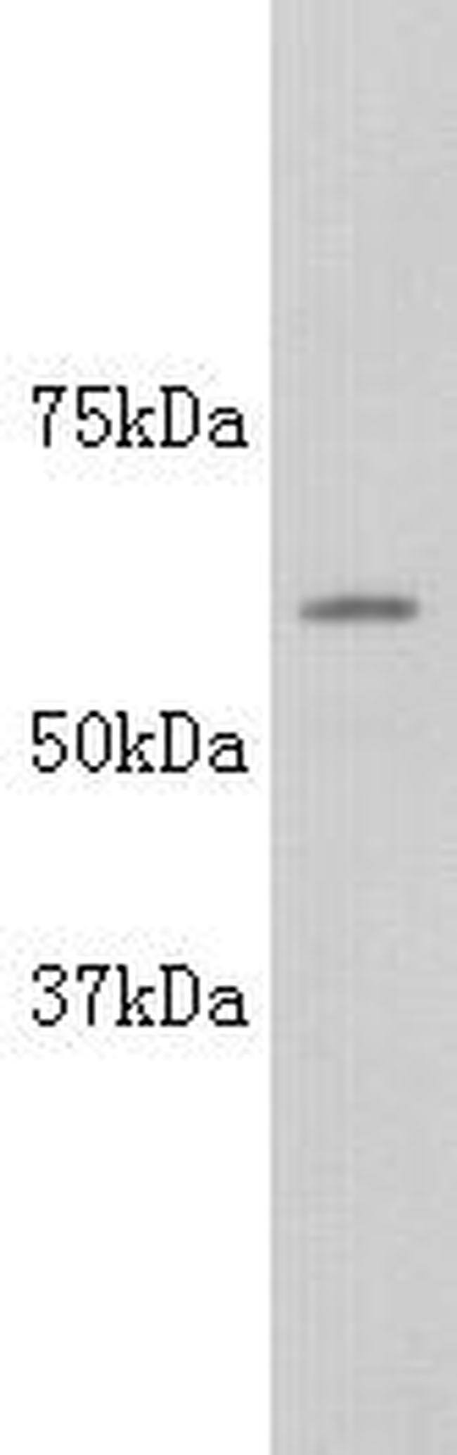 Alkaline Phosphatase (Isoform 4) Antibody in Western Blot (WB)