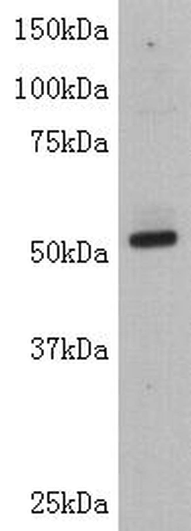 TDT Antibody in Western Blot (WB)