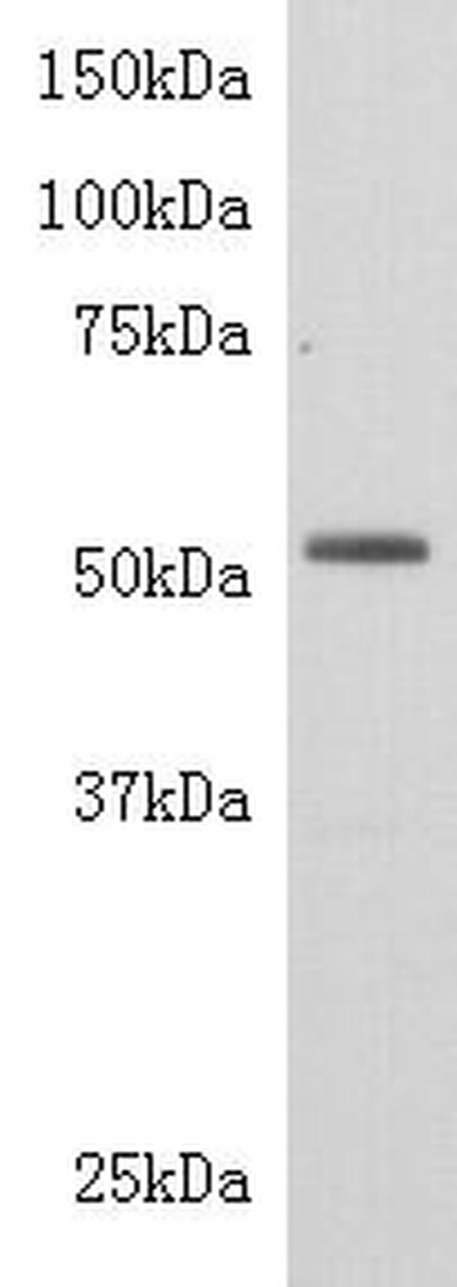 TDT Antibody in Western Blot (WB)