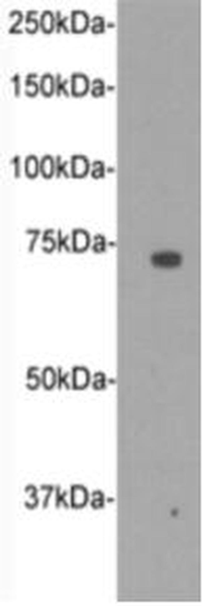 CD105 (Endoglin) Antibody in Western Blot (WB)