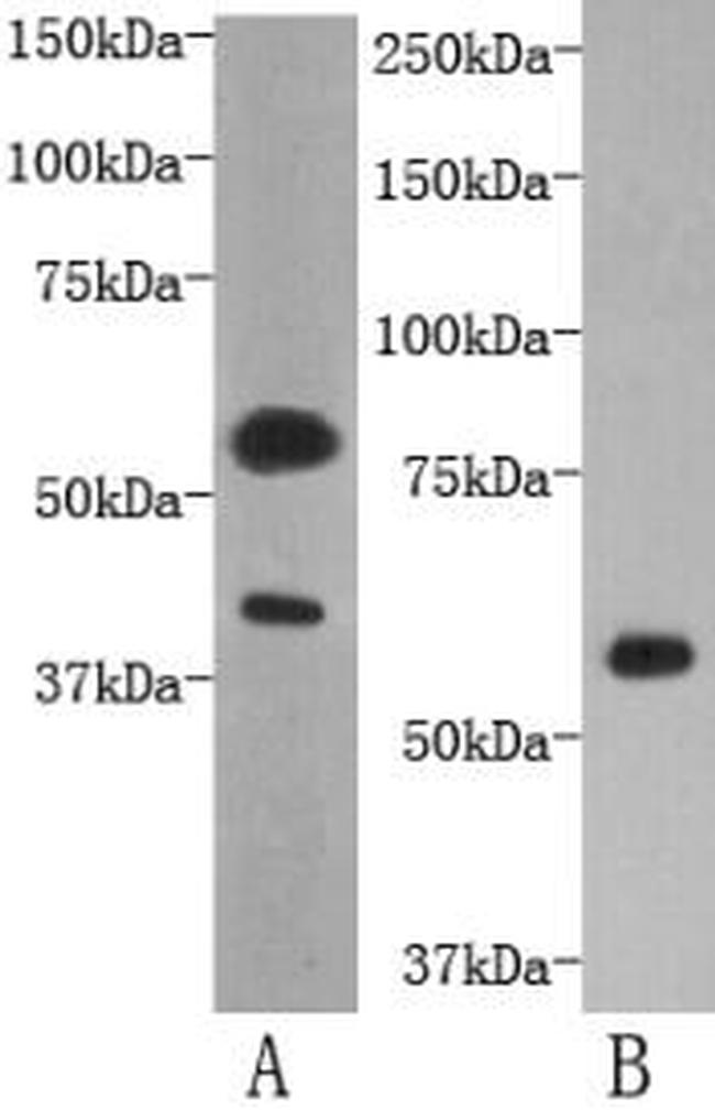 TMEM57 Antibody in Western Blot (WB)