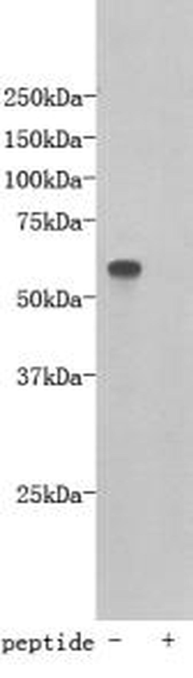 TMEM132E Antibody in Western Blot (WB)