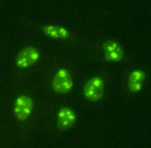 PGBD5 Antibody in Immunocytochemistry (ICC/IF)