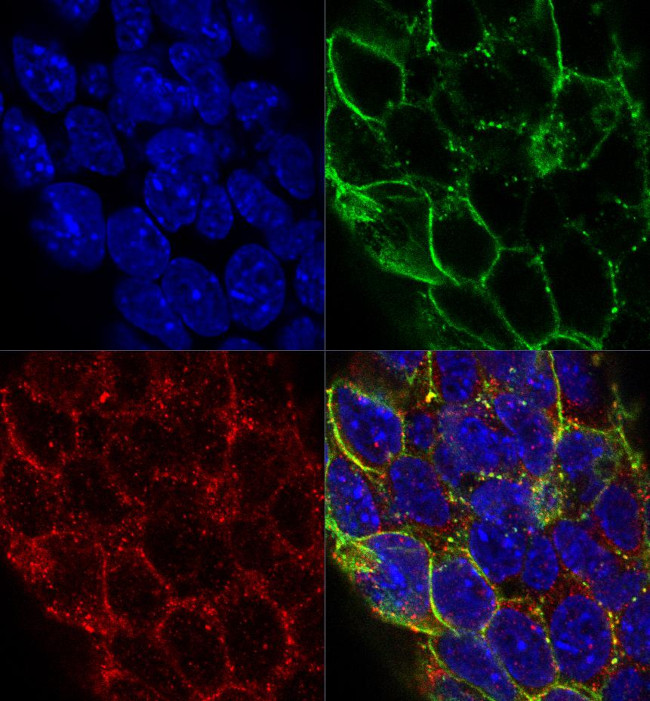 AIRE Antibody in Immunocytochemistry (ICC/IF)
