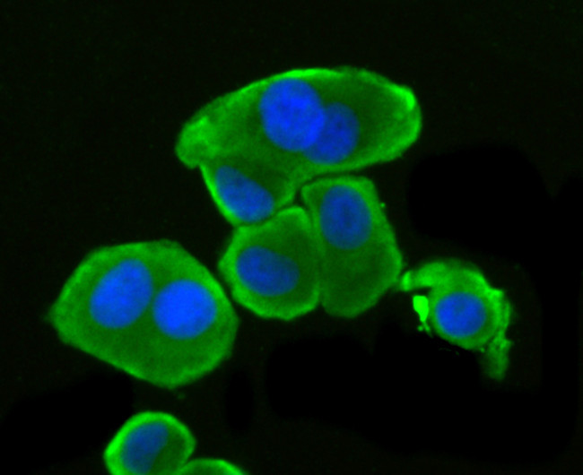 PINK1 Antibody in Immunocytochemistry (ICC/IF)