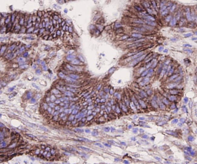 Integrin beta 1 (CD29) Antibody in Immunohistochemistry (Paraffin) (IHC (P))