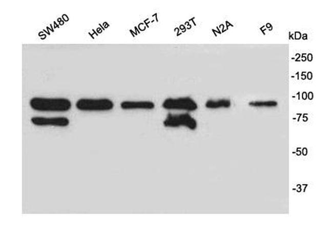 SUZ12 Antibody in Western Blot (WB)