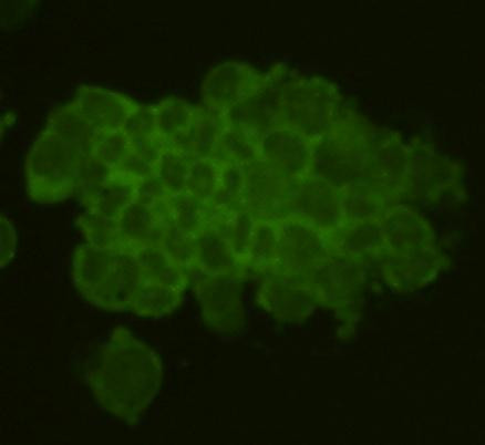 REM2 Antibody in Immunocytochemistry (ICC/IF)