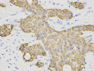 Cytokeratin 7 Antibody in Immunohistochemistry (Paraffin) (IHC (P))