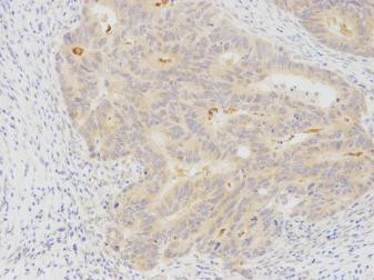 MKRN2 Antibody in Immunohistochemistry (Paraffin) (IHC (P))
