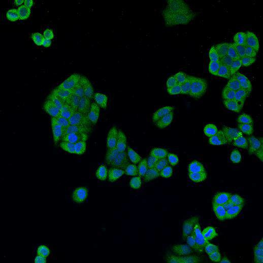 Cathepsin B Antibody in Immunocytochemistry (ICC/IF)