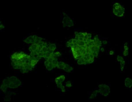 L1ORF1p Antibody in Immunocytochemistry (ICC/IF)