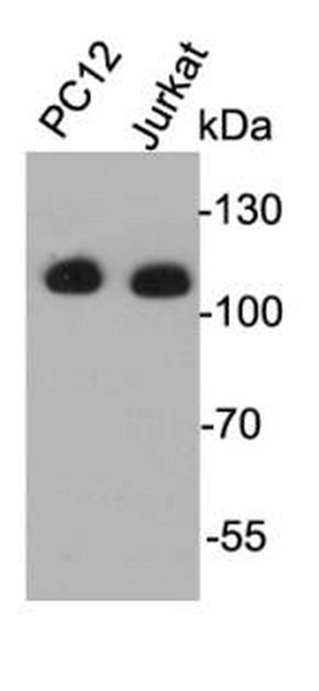 EFTUD2 Antibody in Western Blot (WB)