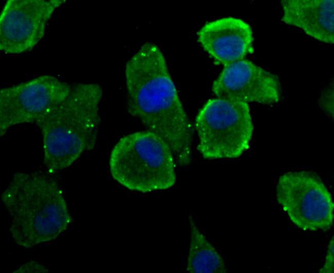 REM2 Antibody in Immunocytochemistry (ICC/IF)