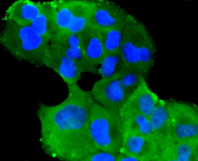 TMEM39A Antibody in Immunocytochemistry (ICC/IF)