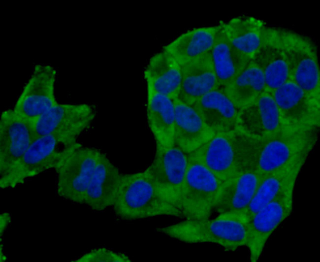 Nestin Antibody in Immunocytochemistry (ICC/IF)