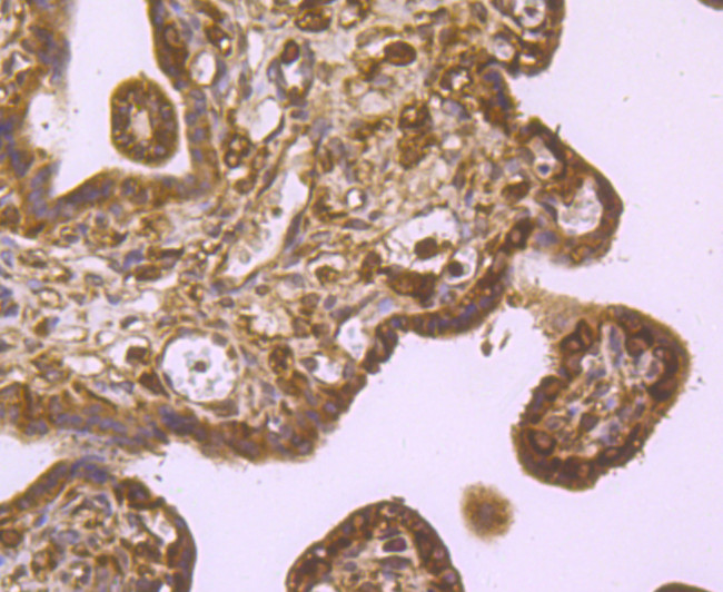 IGF2BP3 Antibody in Immunohistochemistry (Paraffin) (IHC (P))