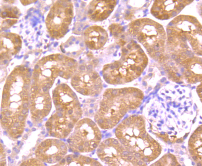 AKR1C1 Antibody in Immunohistochemistry (Paraffin) (IHC (P))