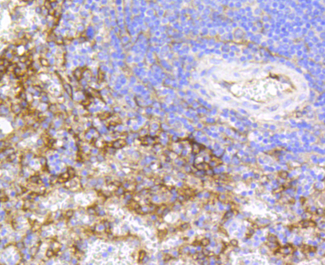 VCAM-1 (CD106) Antibody in Immunohistochemistry (Paraffin) (IHC (P))