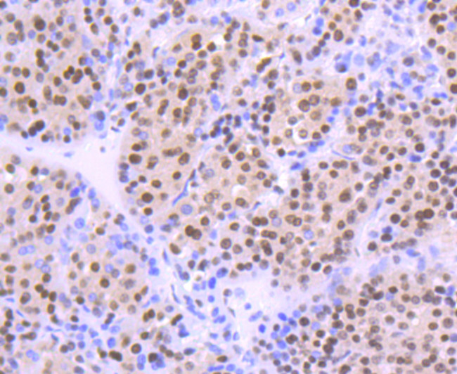 OGG1 Antibody in Immunohistochemistry (Paraffin) (IHC (P))