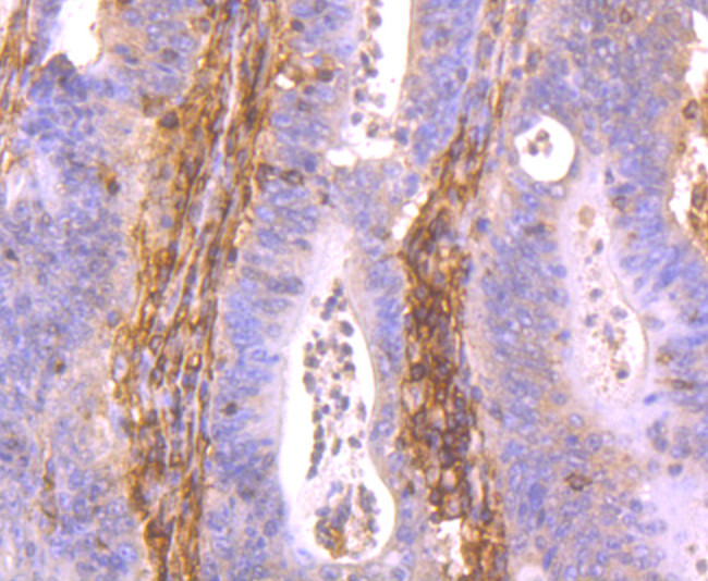 HLA-AB Antibody in Immunohistochemistry (Paraffin) (IHC (P))