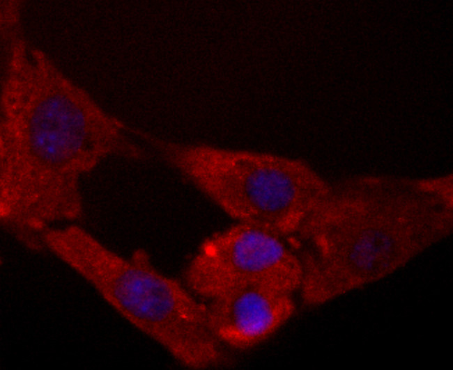 MTERFD1 Antibody in Immunocytochemistry (ICC/IF)