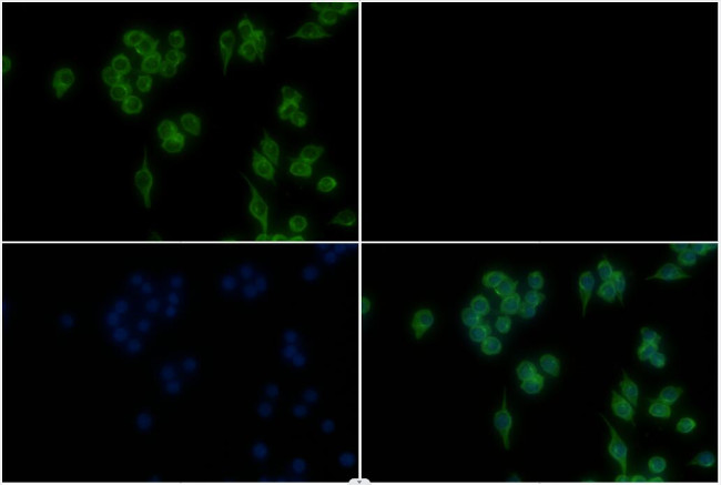 beta Tubulin Antibody in Immunocytochemistry (ICC/IF)