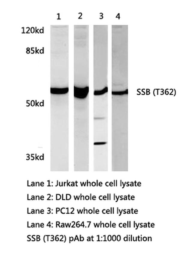 SSB Antibody in Western Blot (WB)