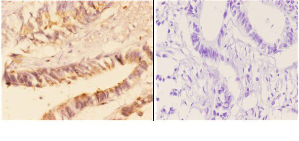 Acetylcholinesterase Antibody in Immunohistochemistry (Paraffin) (IHC (P))