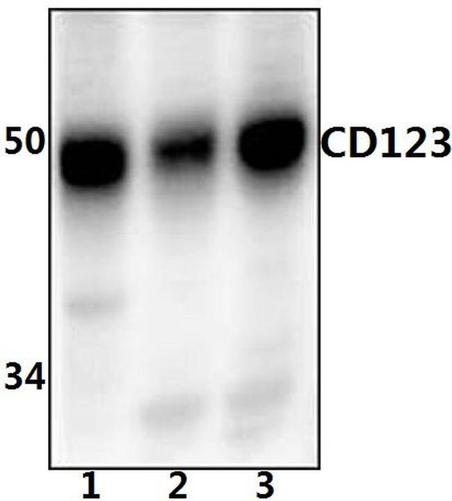 CD123 Antibody in Western Blot (WB)