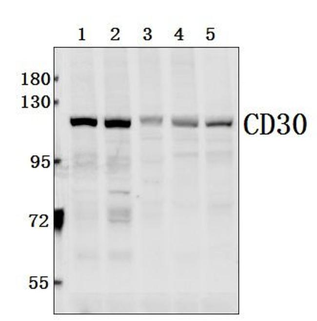 CD30 Antibody in Western Blot (WB)